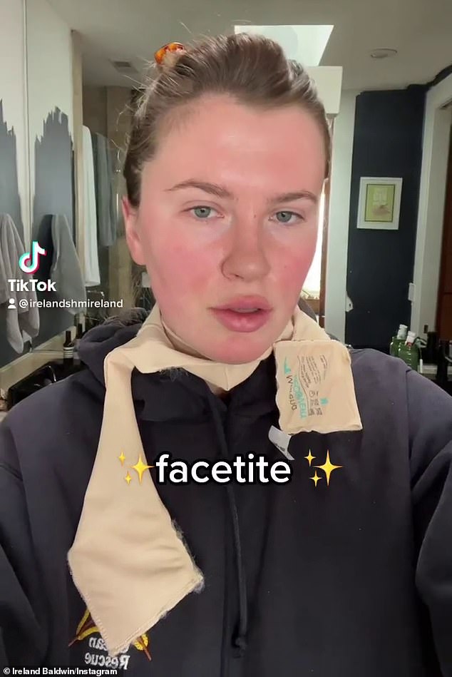 Dürüst: İrlanda Baldwin, bu ay neden cerrahi bir yüz gerdirme ile karşılaştırılabilir minimal invaziv bir kozmetik prosedür olan FaceTite'dan geçtiğini anlatıyor.