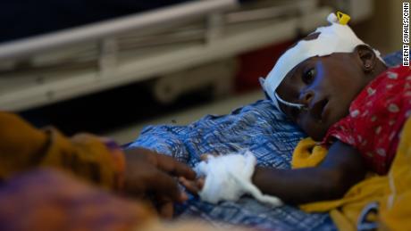 Fatima Abdullah, Temmuz ayında Somali'de ağır beslenme yetersizliği nedeniyle hastaneye kaldırılan 8 aylık kızı Abdi'ye dokunmak için elini uzatıyor.